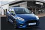 2020 Ford Fiesta 1.0 EcoBoost ST-Line X 5dr